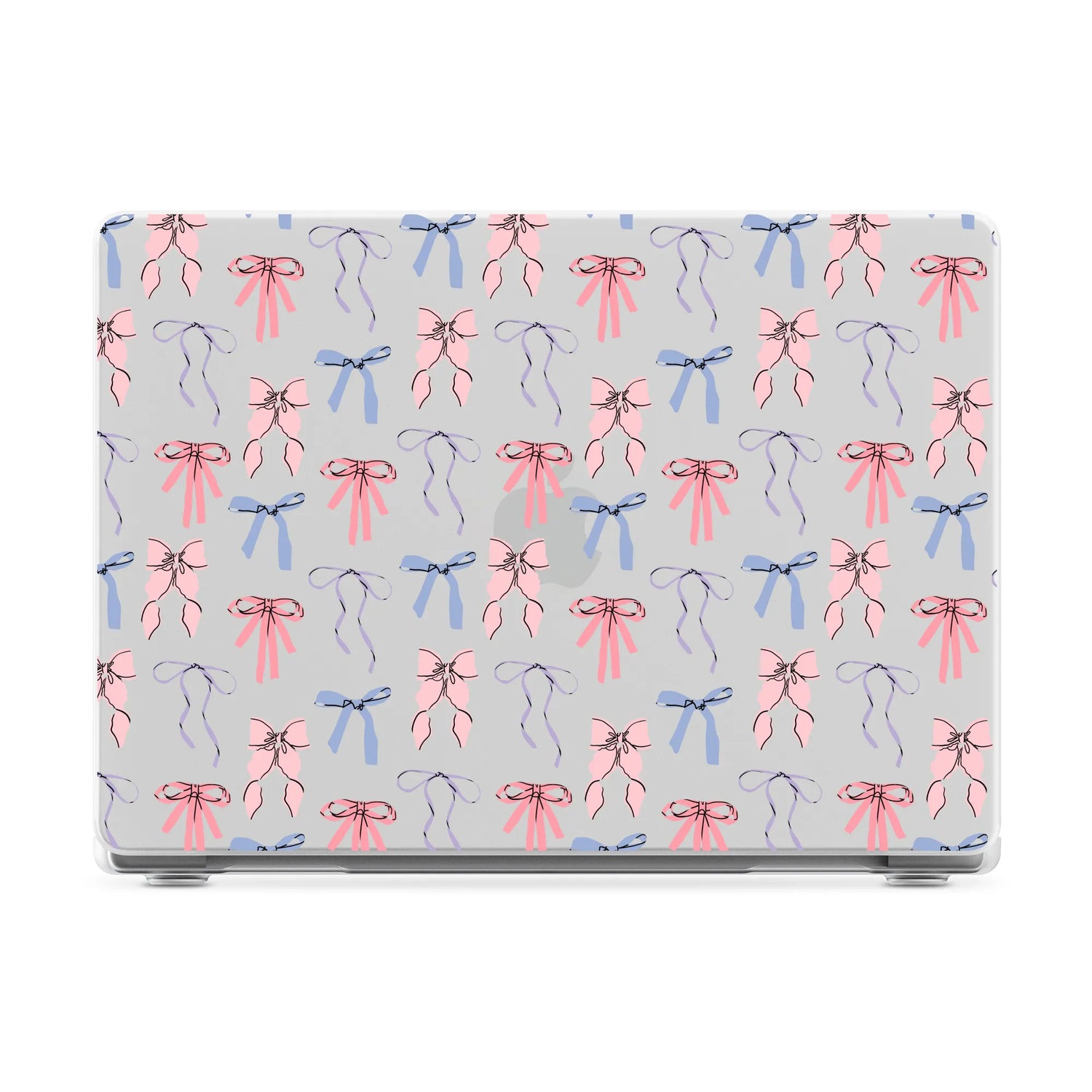 Coquette Girlie | Pastel Bows Laptop Shell